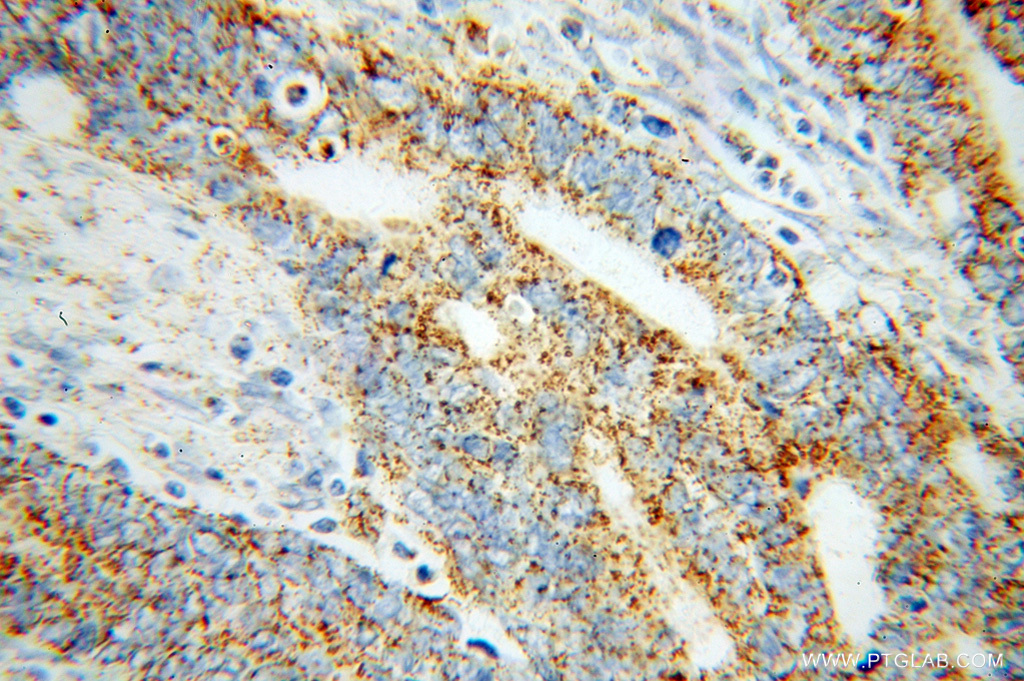 MCCC1 Polyclonal antibody