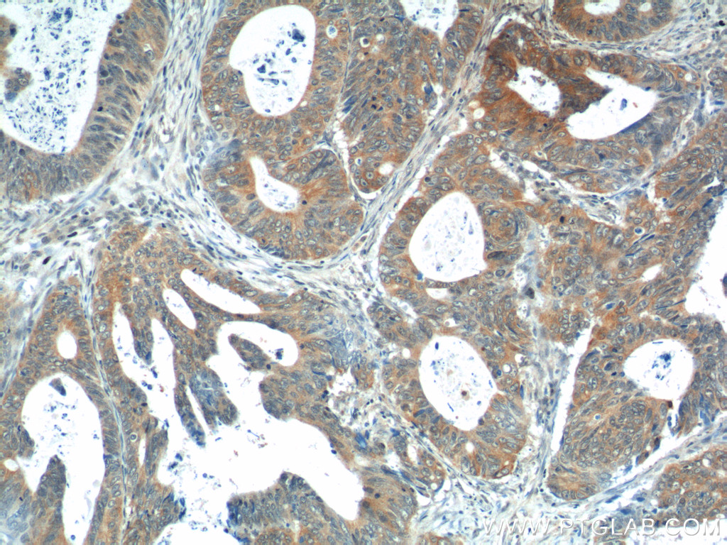 Calcipressin 1 Polyclonal antibody