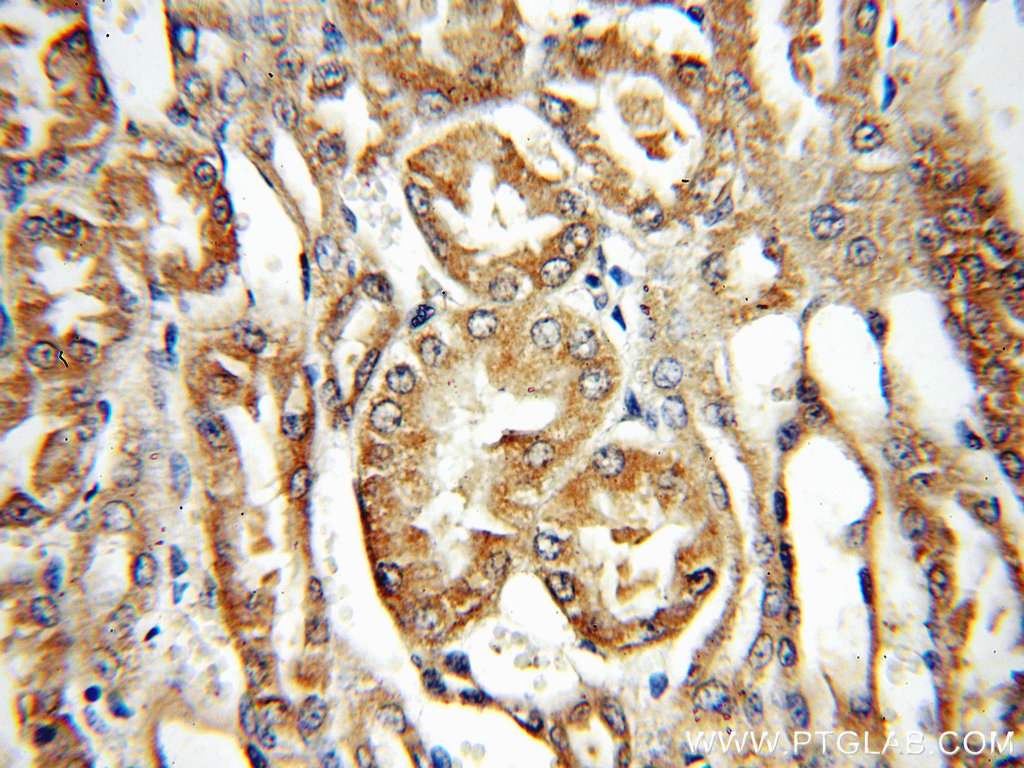 PPOX Polyclonal antibody