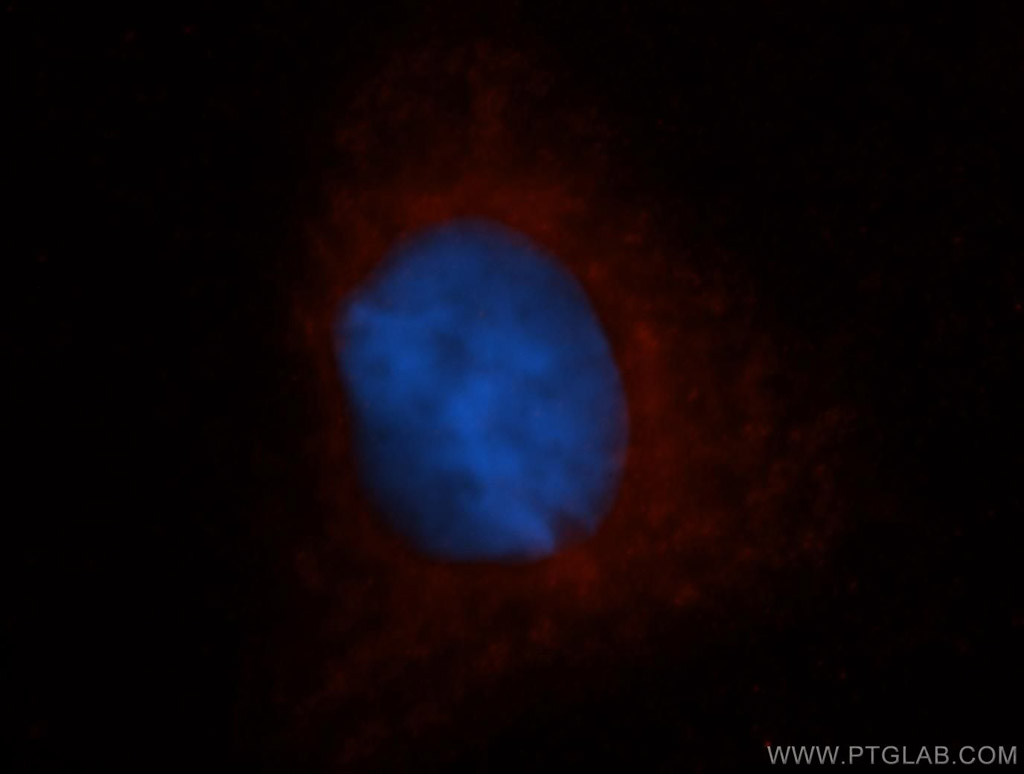 DHODH Polyclonal antibody