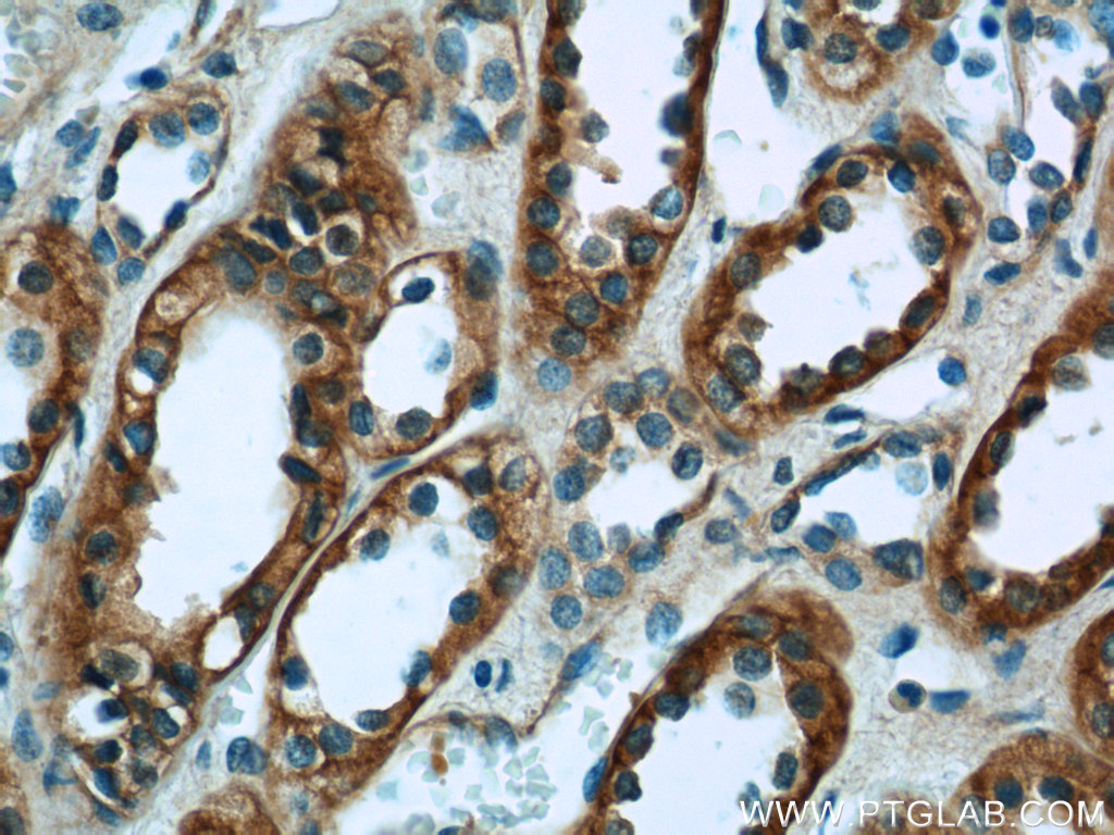 VIPR1 Polyclonal antibody