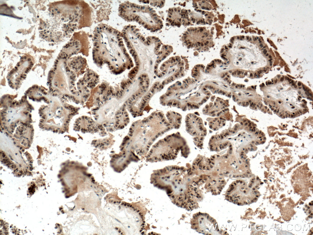 BTG1 Polyclonal antibody