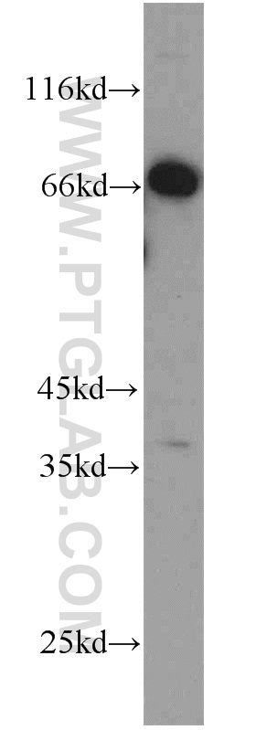 C1orf116 Polyclonal antibody