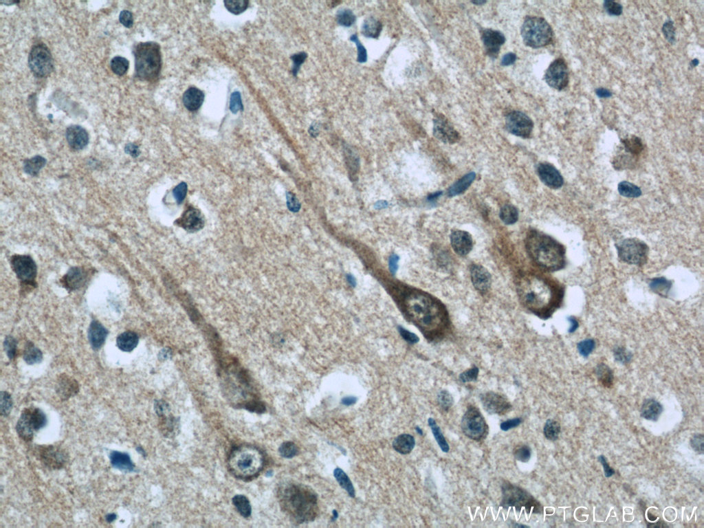 ABI2 Polyclonal antibody
