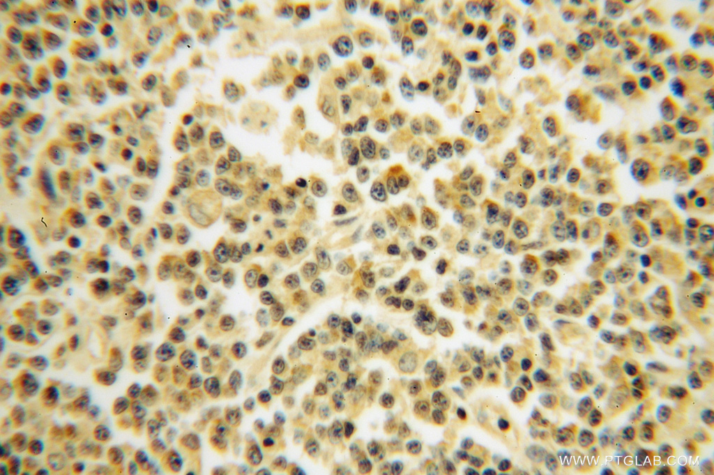 RPS10 Polyclonal antibody