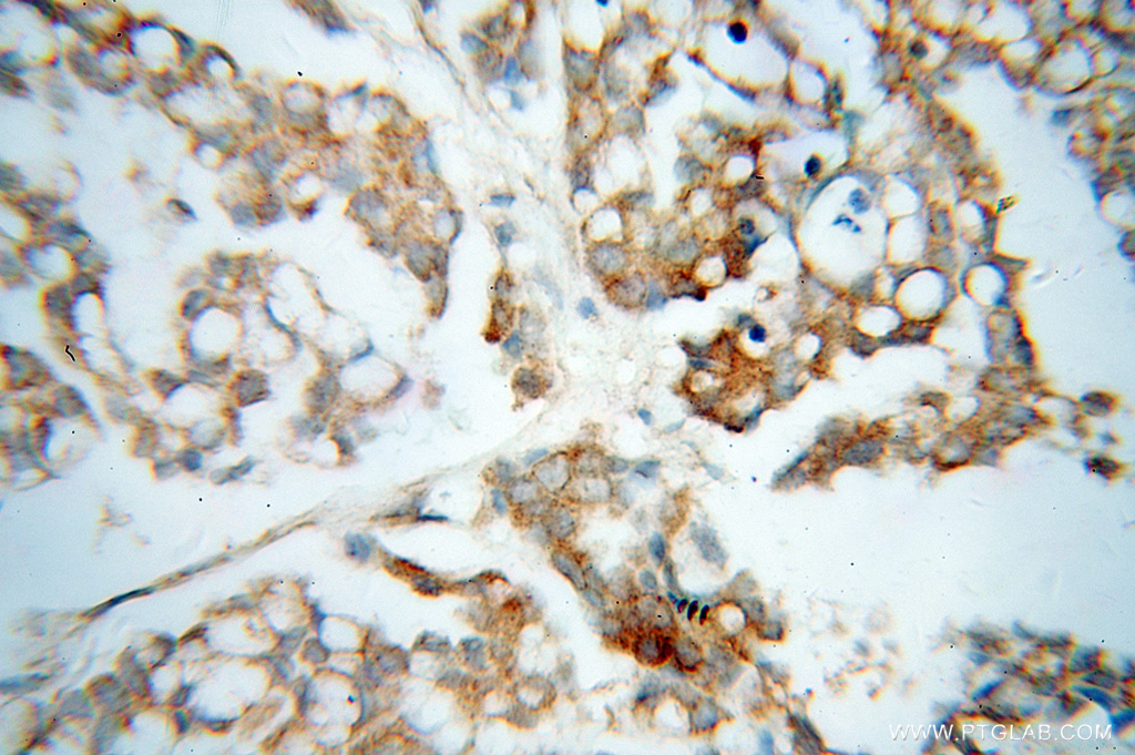 QDPR Polyclonal antibody
