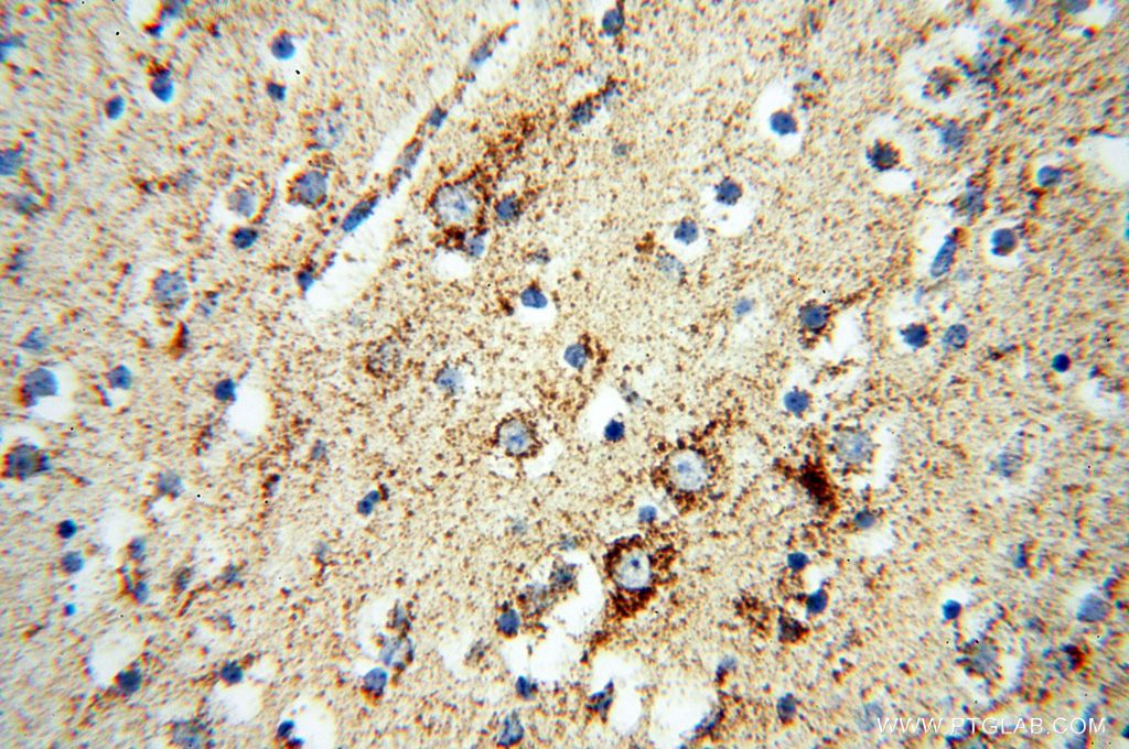 NDUFB7 Polyclonal antibody