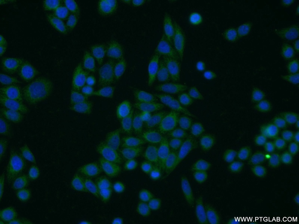 TOB1 Polyclonal antibody