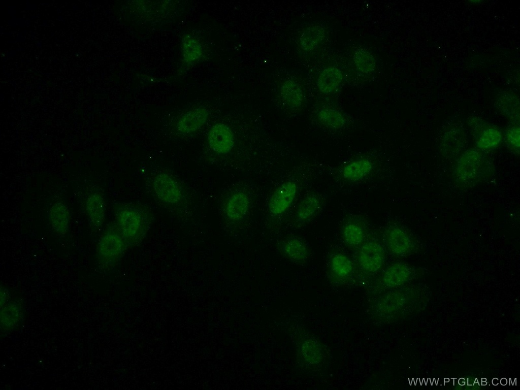 MEPCE Polyclonal antibody
