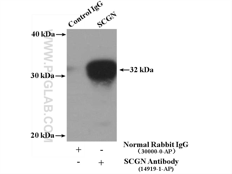SCGN Polyclonal antibody