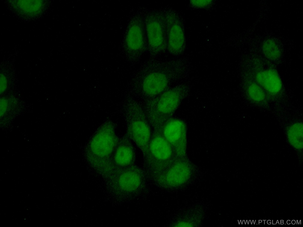 THUMPD1 Polyclonal antibody