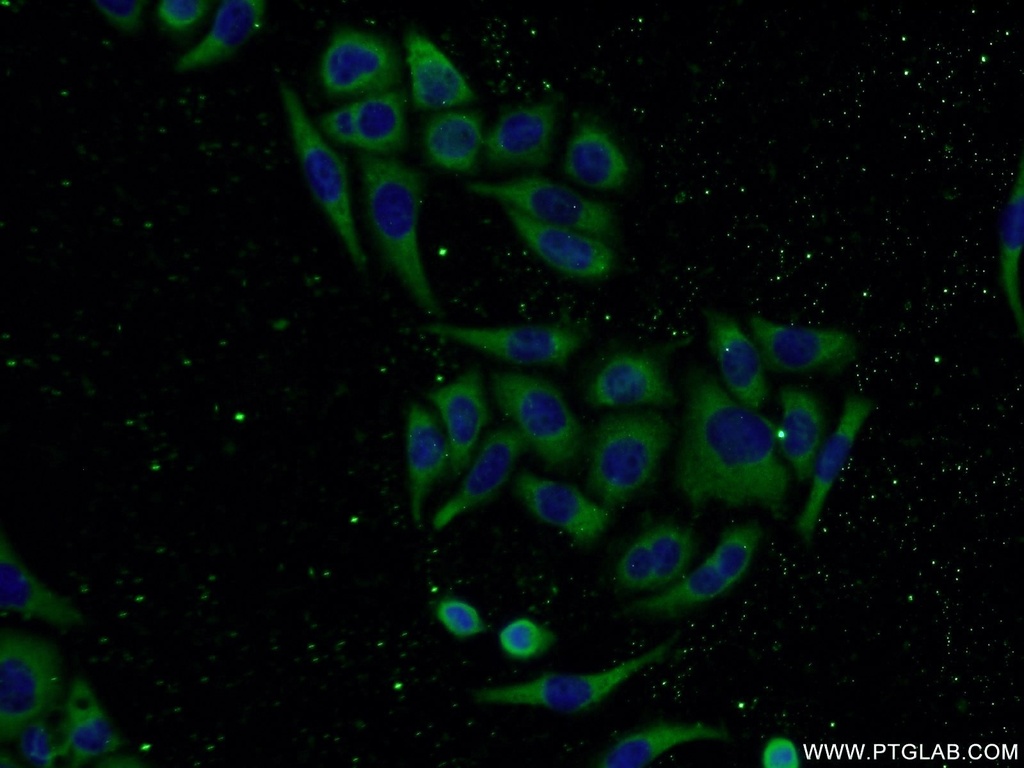 CNDP2 Polyclonal antibody