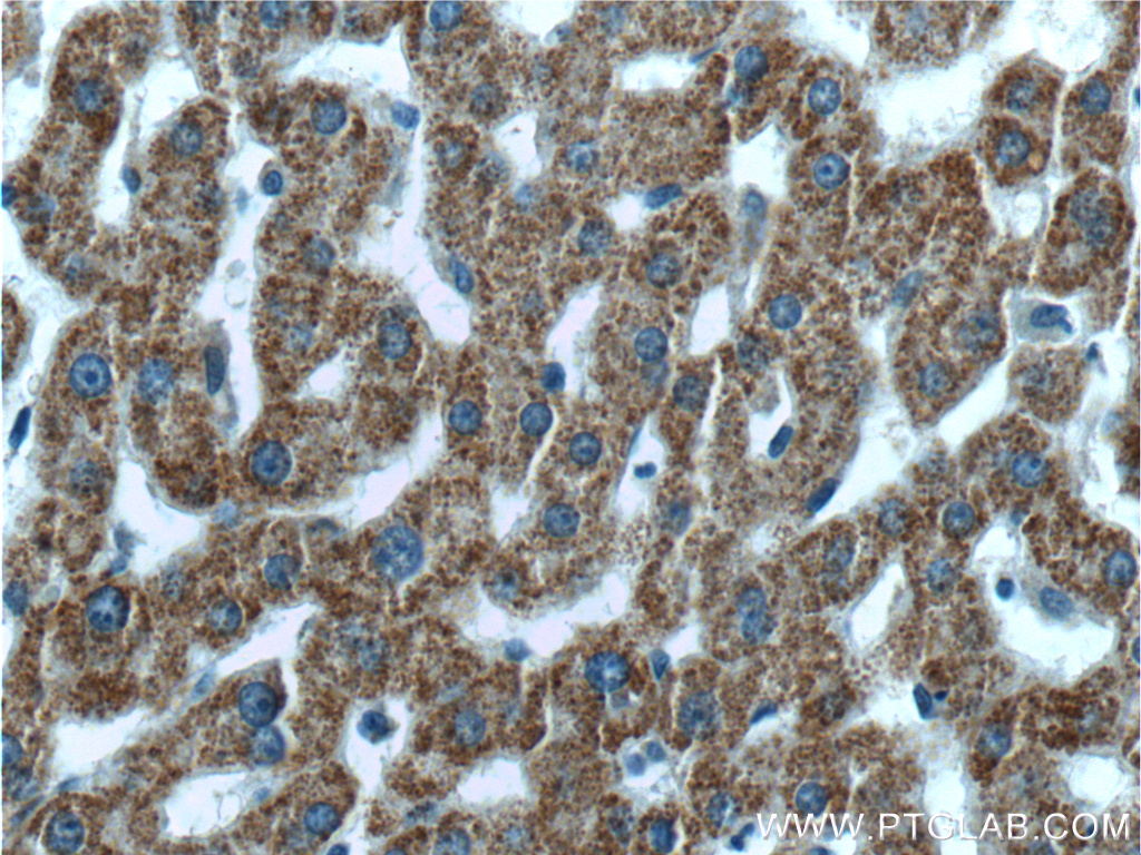 GCDH Polyclonal antibody