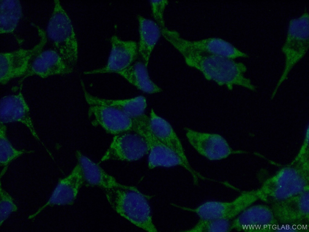 MECR Polyclonal antibody