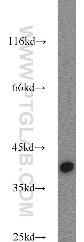 URAT1 Polyclonal antibody