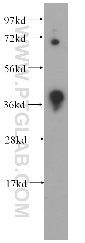 DNMT3L Polyclonal antibody