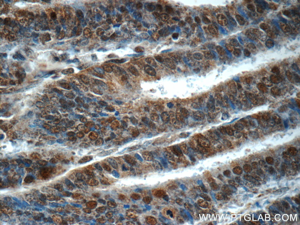 RPS27A Polyclonal antibody