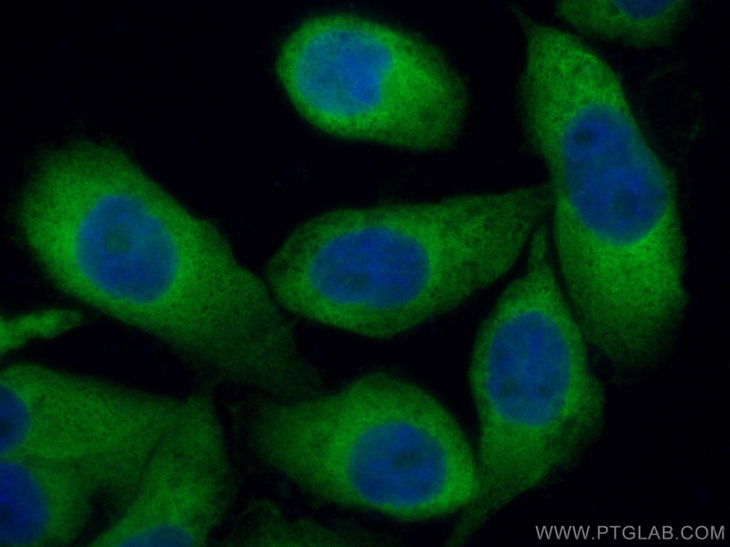 KARS Polyclonal antibody