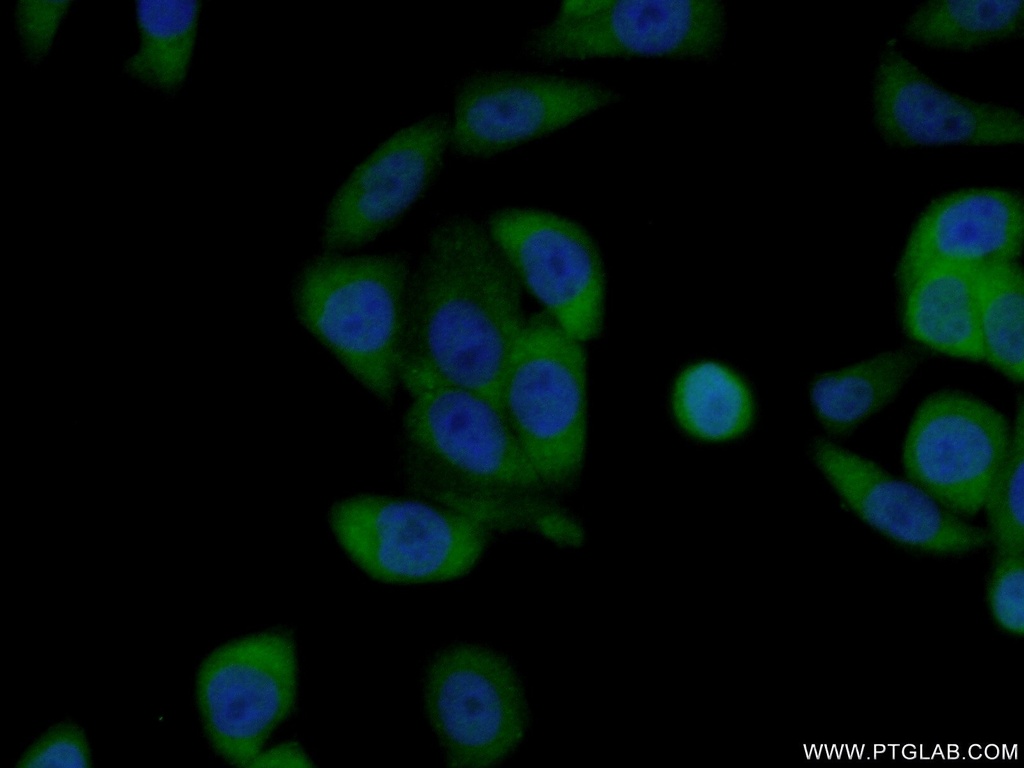 OAS1 Polyclonal antibody