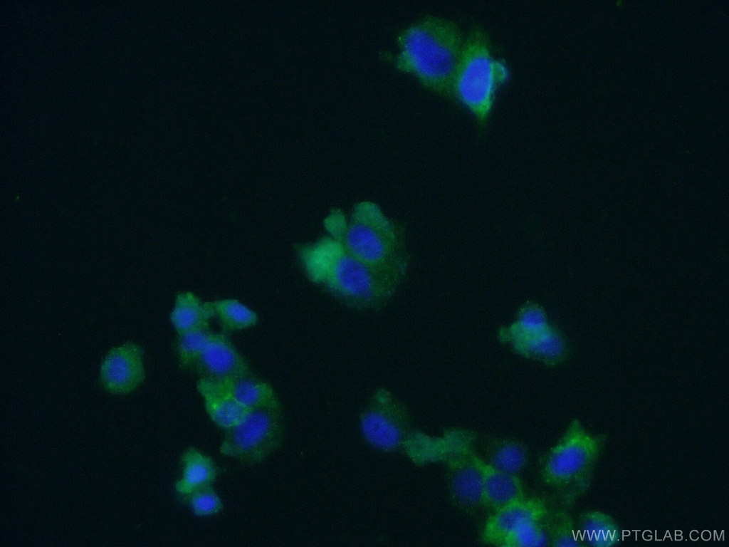 Chromogranin B Polyclonal antibody