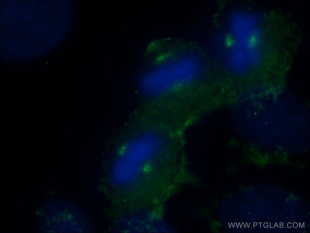 KATNB1 Polyclonal antibody