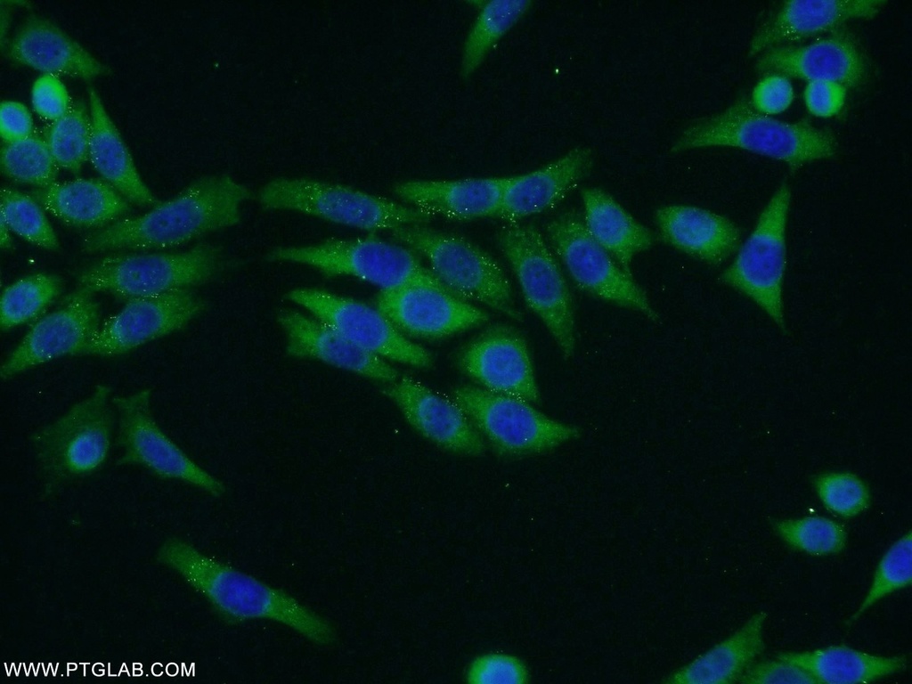 TRMT1 Polyclonal antibody