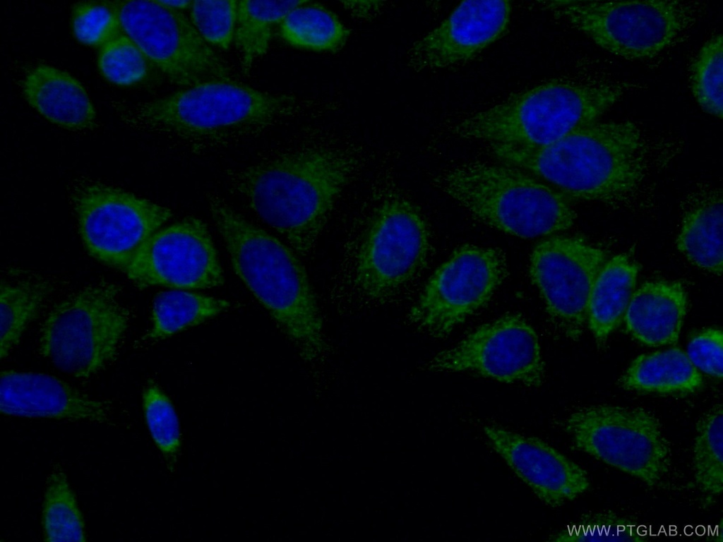 UQCRQ Polyclonal antibody