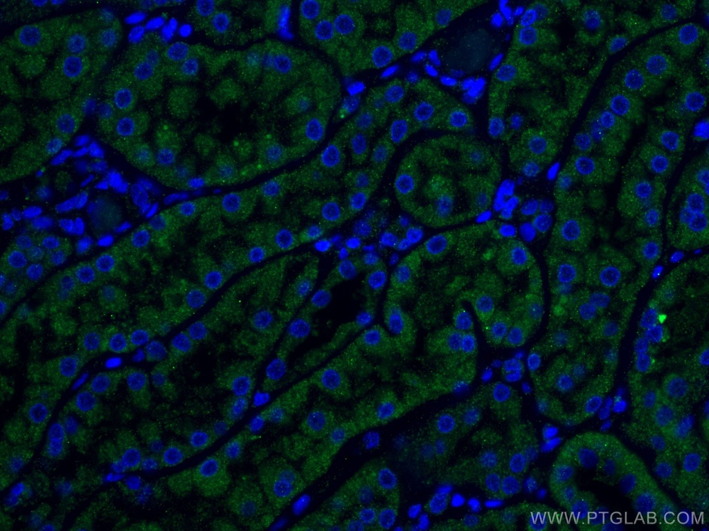 TCTN1 Polyclonal antibody