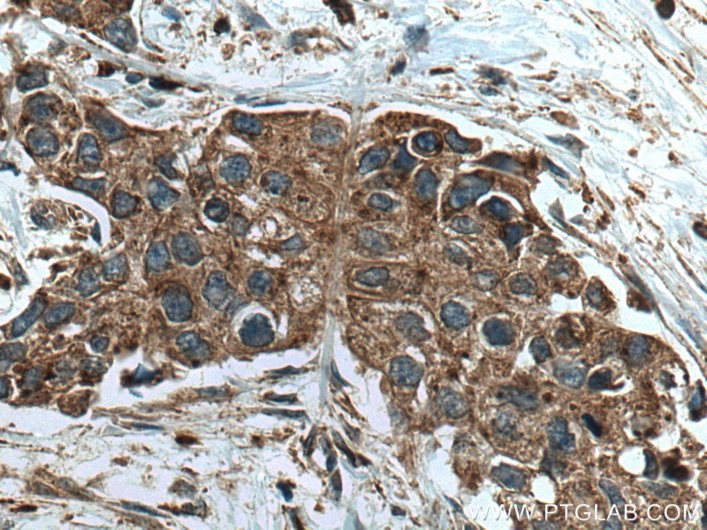 Cathepsin A Polyclonal antibody