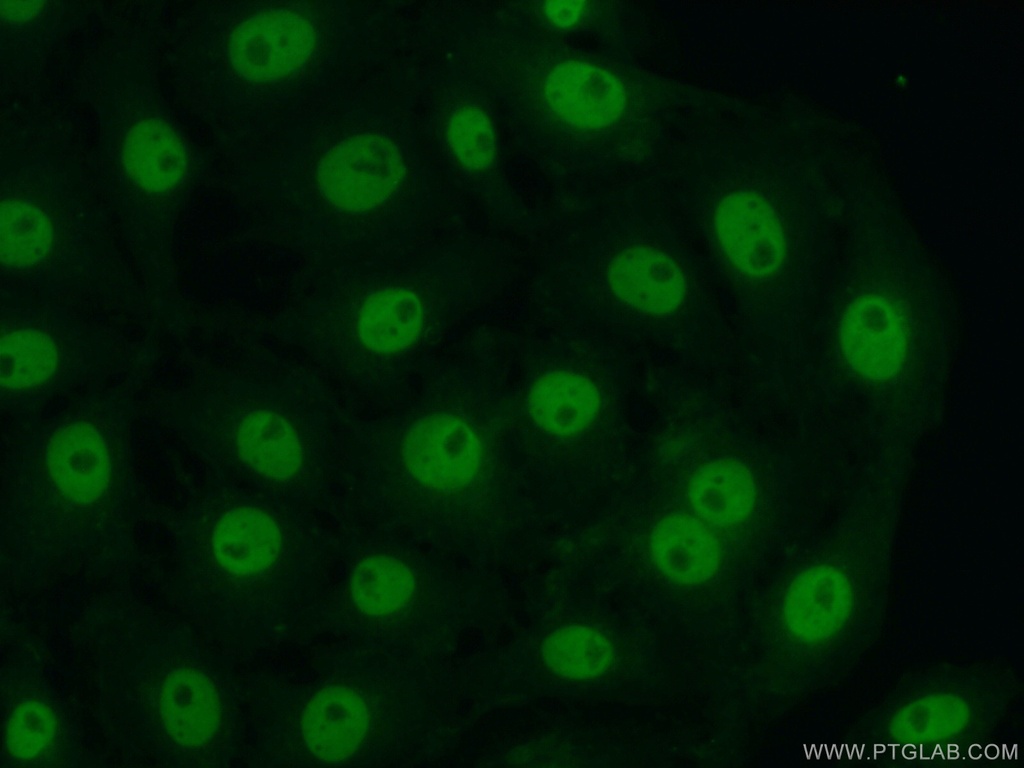 CITED2 Polyclonal antibody