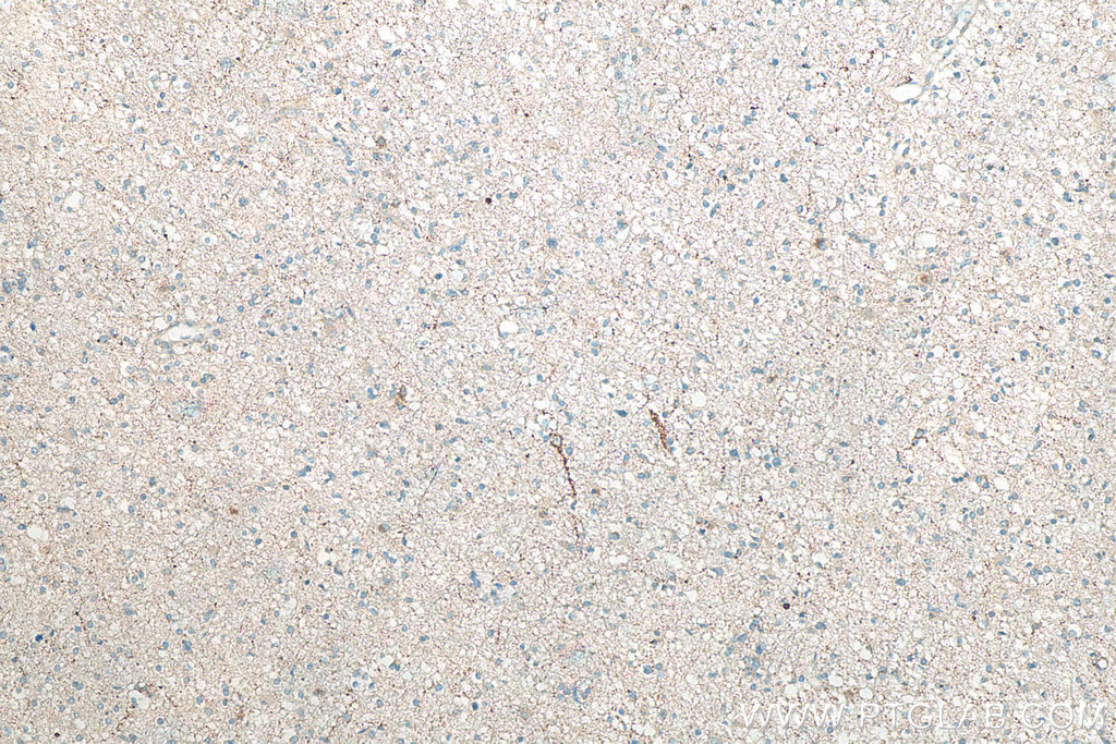 RAB3A Polyclonal antibody