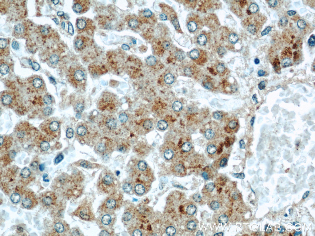 CMTM8 Polyclonal antibody