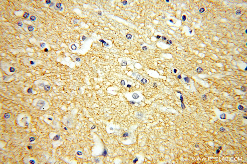 GPM6A Polyclonal antibody