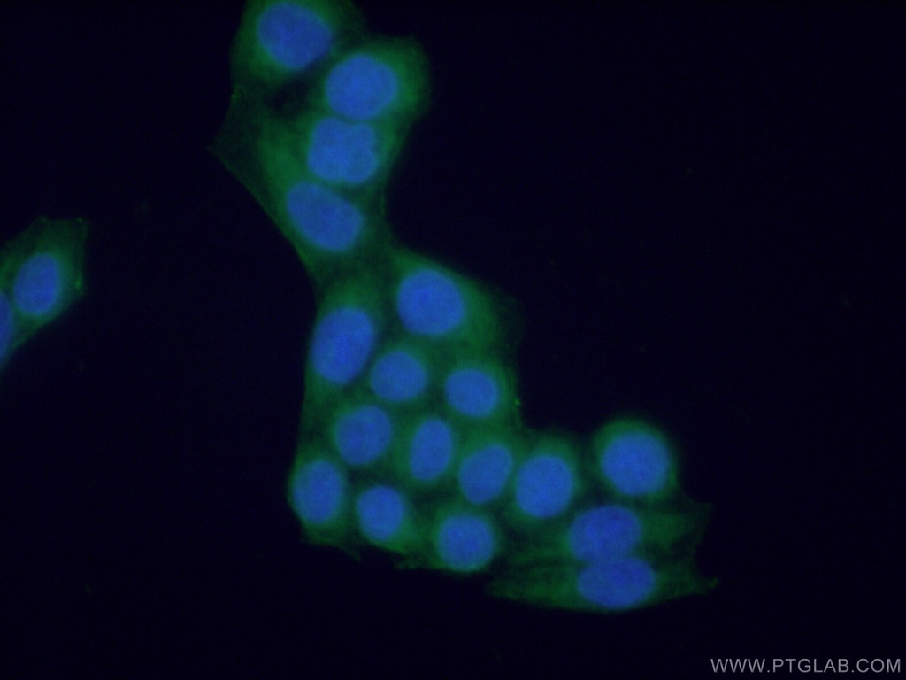 NAGK Polyclonal antibody