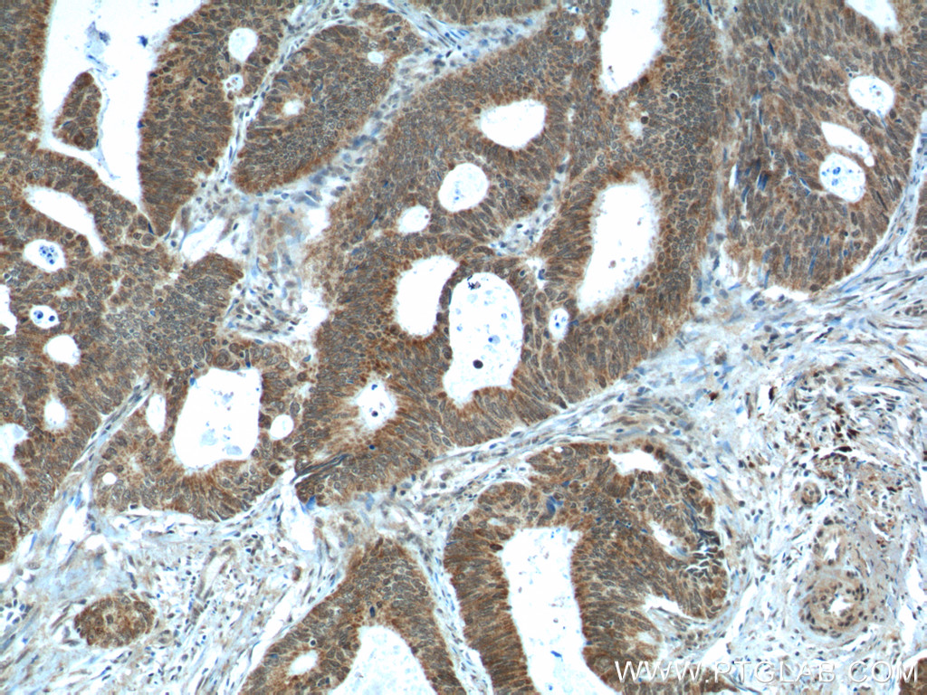 NUPR1 Polyclonal antibody