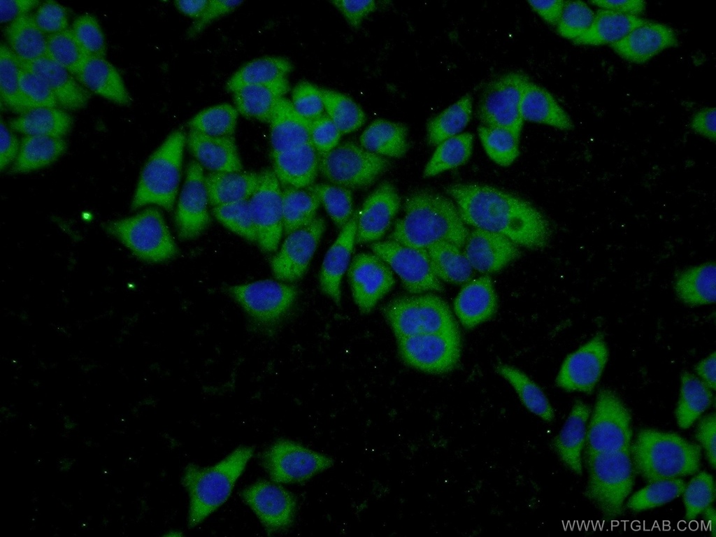 GSTT2 Polyclonal antibody