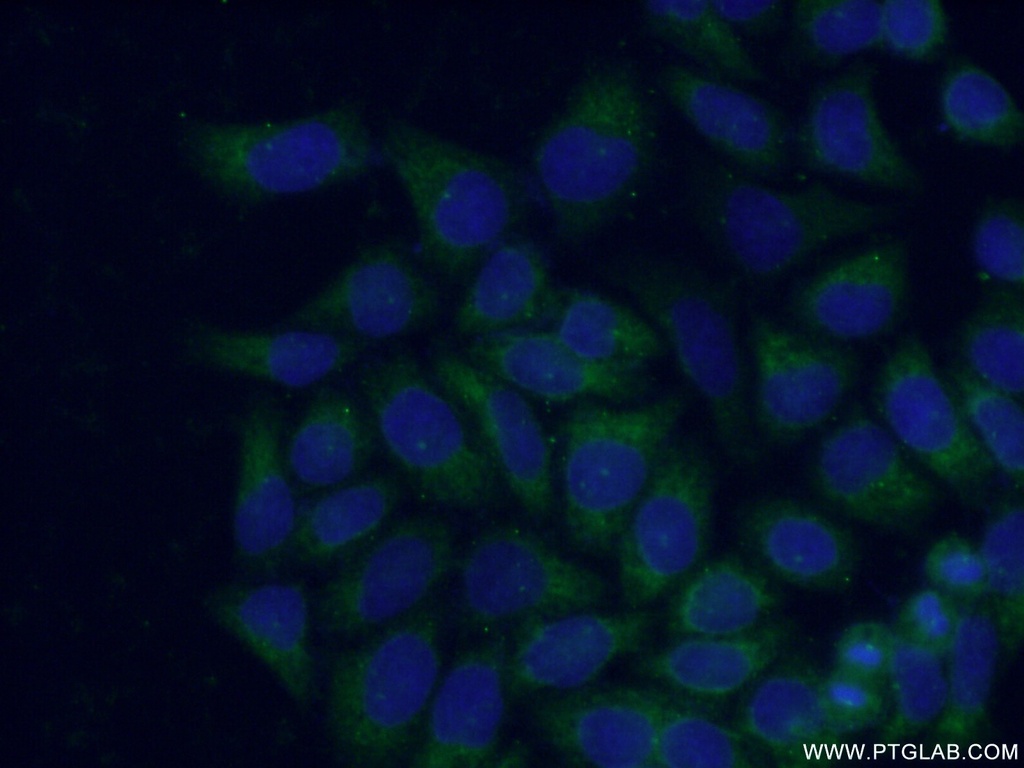 HPS1 Polyclonal antibody