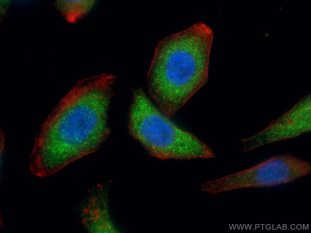 VPS8 Polyclonal antibody