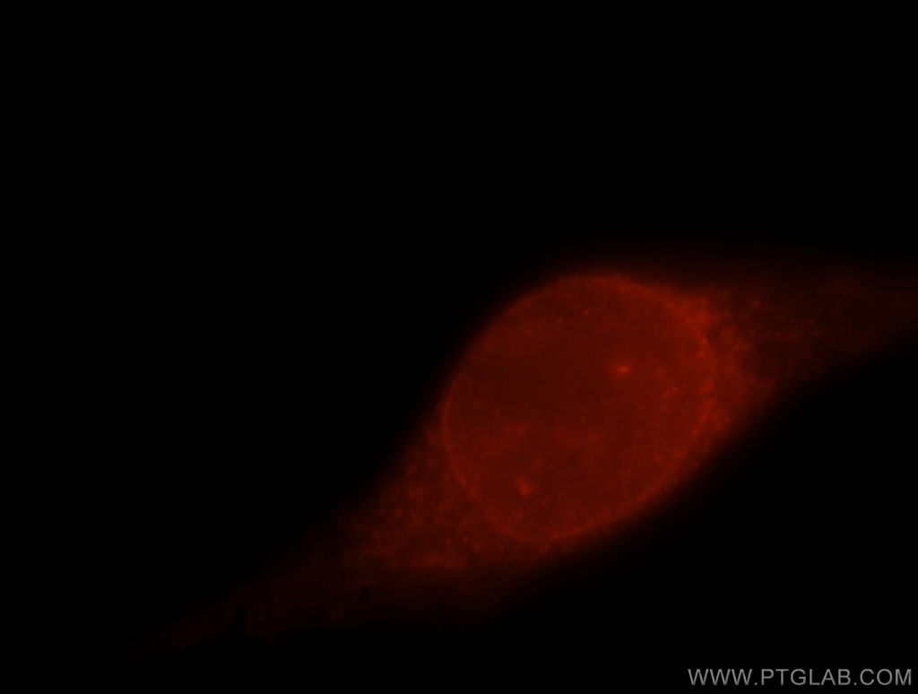 POLDIP2 Polyclonal antibody