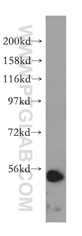 LPCAT2 Polyclonal antibody