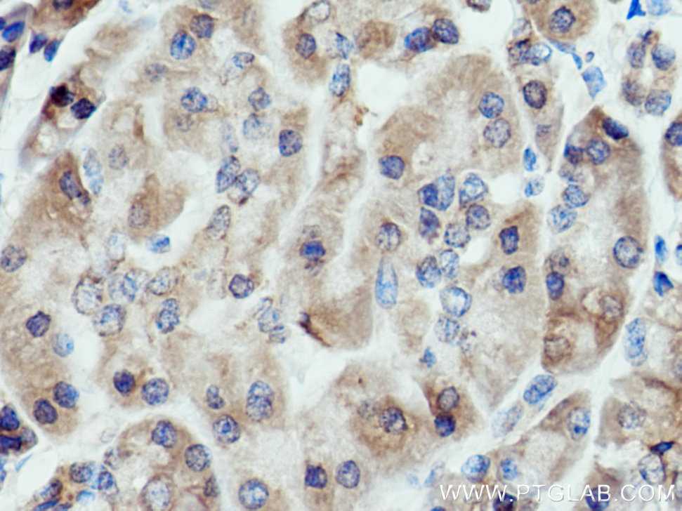 ALG2 Polyclonal antibody
