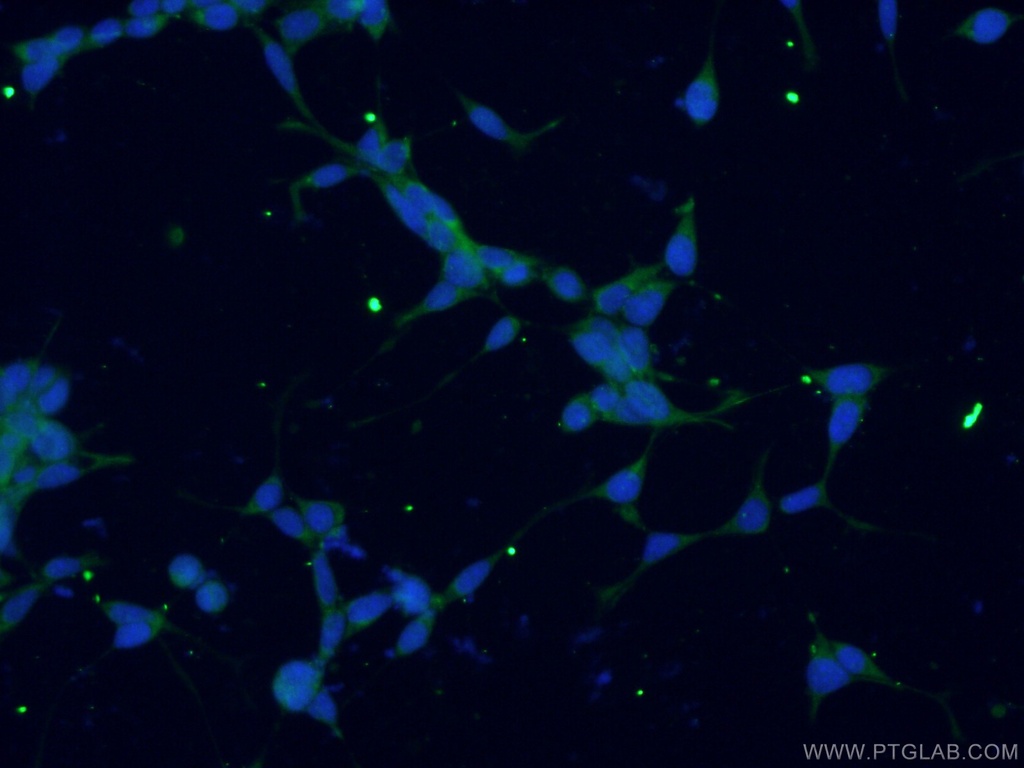 GMPPB Polyclonal antibody
