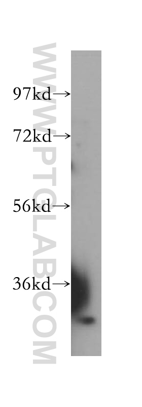 DHDDS Polyclonal antibody