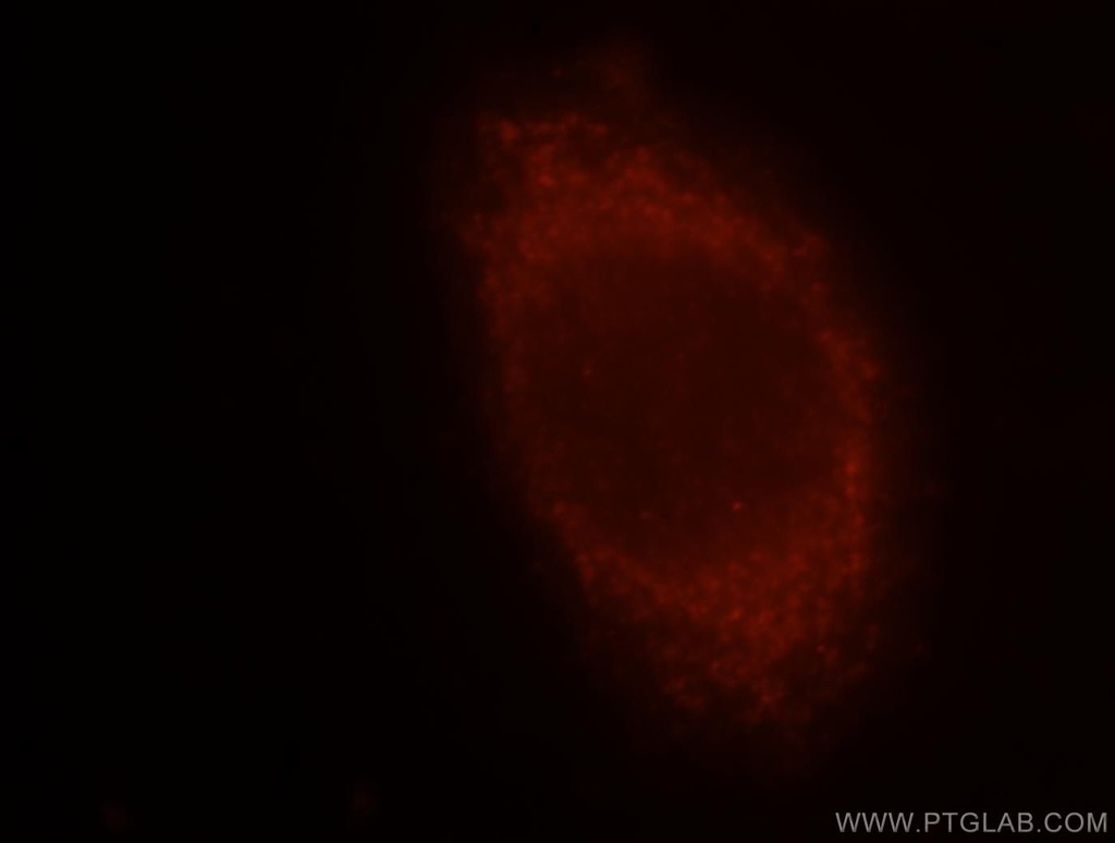 MGAT1 Polyclonal antibody