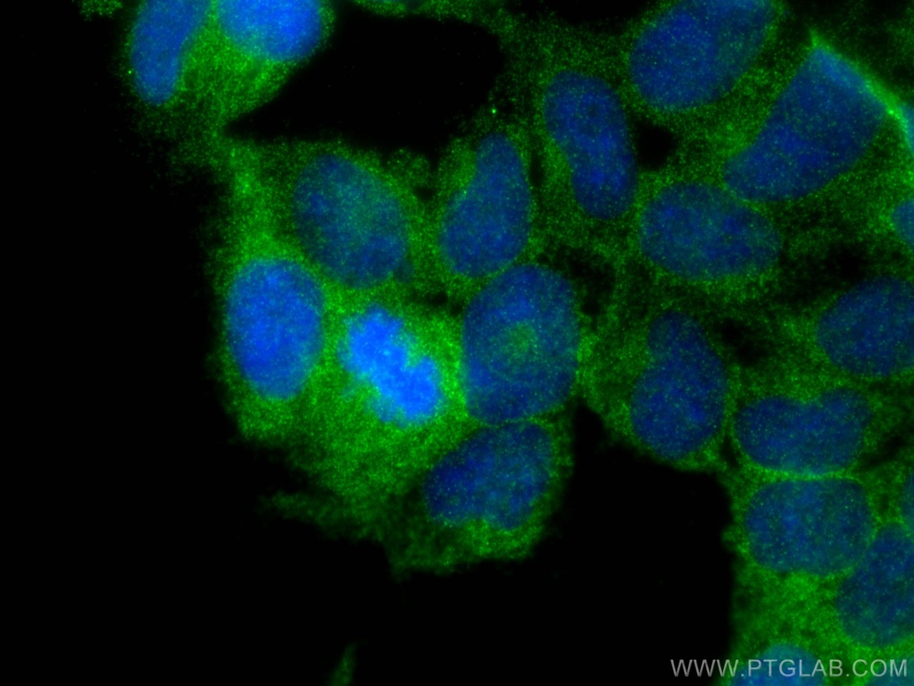PHKG2 Polyclonal antibody