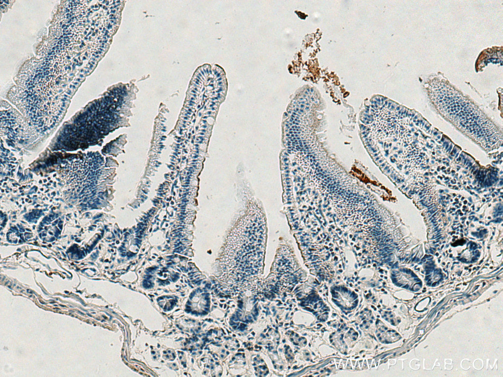 Villin Polyclonal antibody