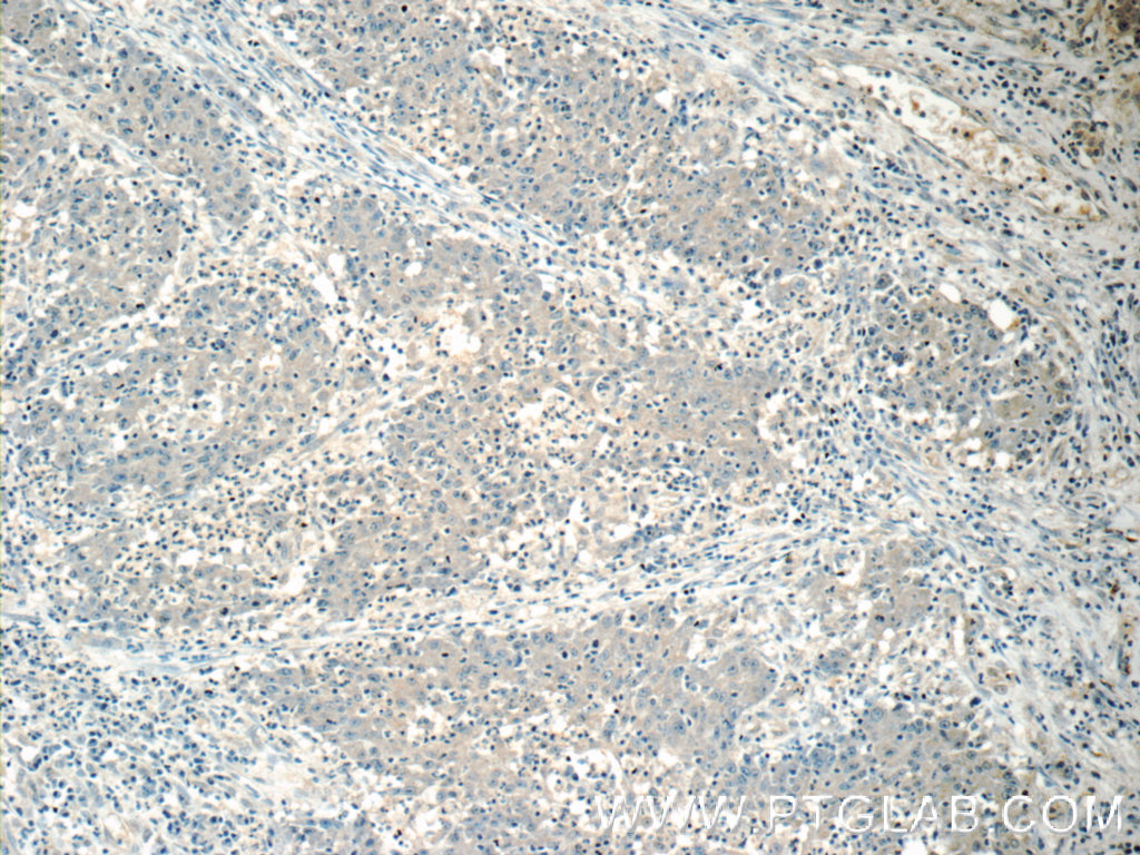 HSCB Polyclonal antibody