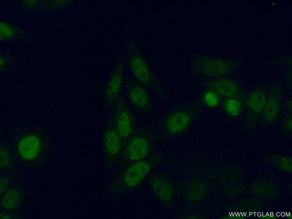 GTF2F2 Polyclonal antibody