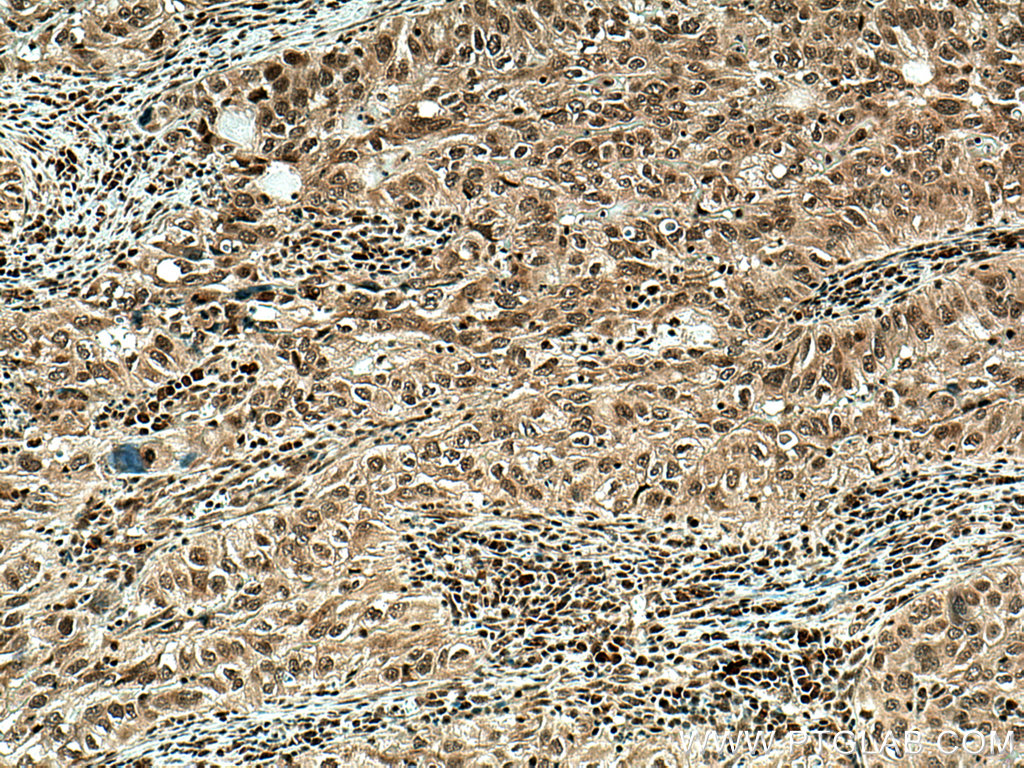 hnRNP-E1 Polyclonal antibody