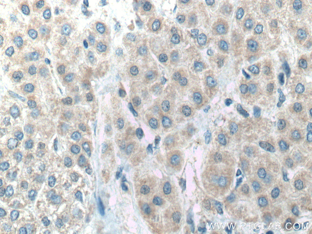ACADVL Polyclonal antibody